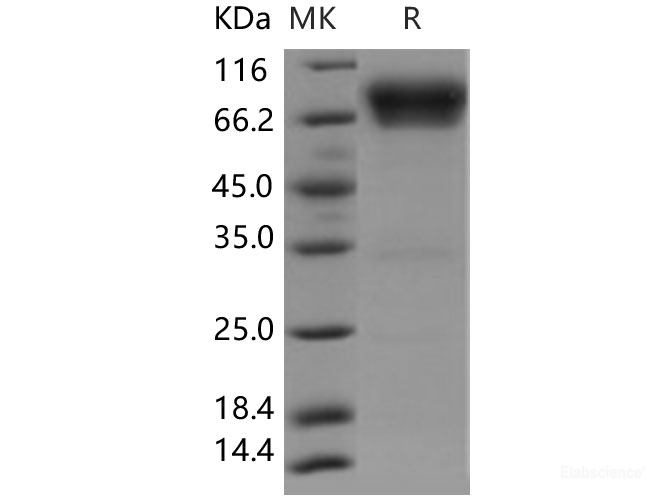 Recombinant Human B7-H4 / B7S1 / B7x Protein (Fc tag)-Elabscience