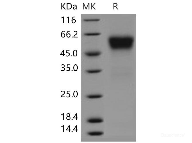 Recombinant Human sFRP4 Protein (His tag)-Elabscience