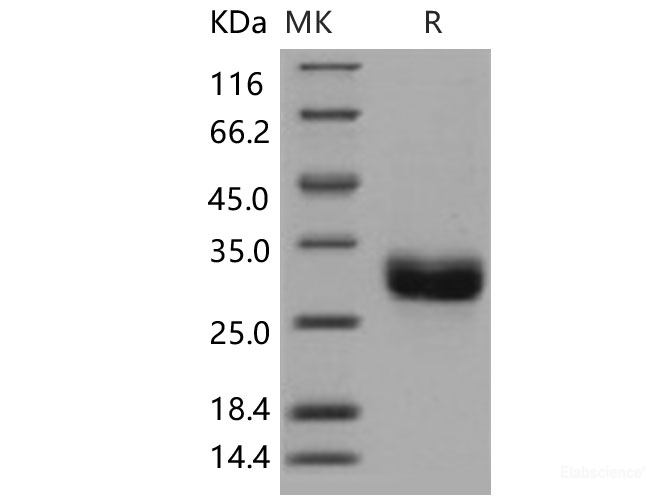 Recombinant Human ULBP1 / N2DL1 Protein (His tag)-Elabscience