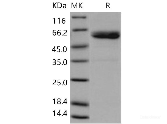 Recombinant Human ULBP1 / RAET1 / N2DL1 Protein (His & Fc tag)-Elabscience