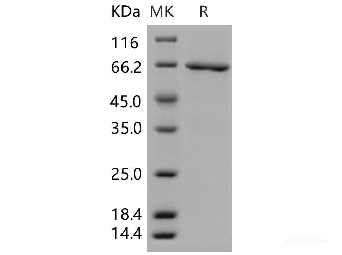 Recombinant Human SerpinB2 / PAI-2 Protein (GST tag)-Elabscience