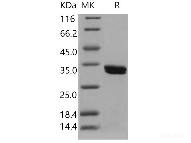 Recombinant Human CDK2 Protein (His Tag)-Elabscience