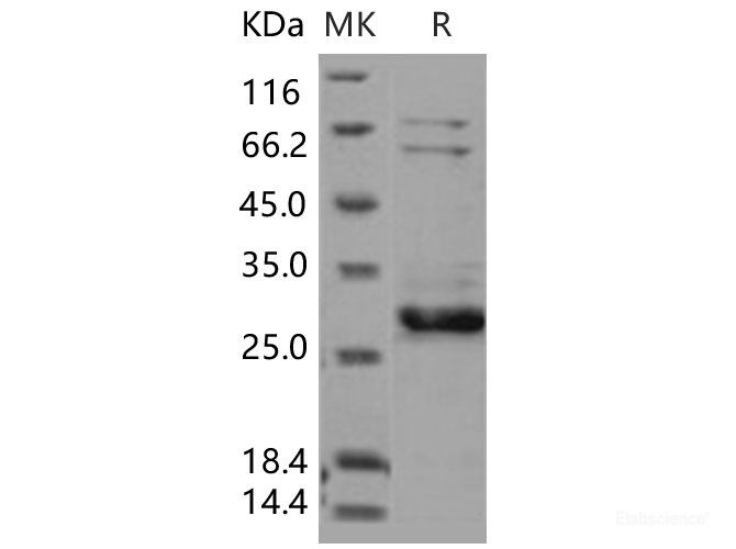 Recombinant Human XIAP / BIRC4 Protein (AVI tag)-Elabscience