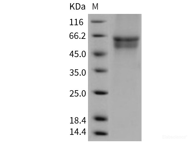 Recombinant Human IL3RA / CD123 Protein (His tag)-Elabscience