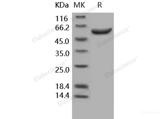 Recombinant Human Arylsulfatase A / ARSA Protein (His tag)-Elabscience