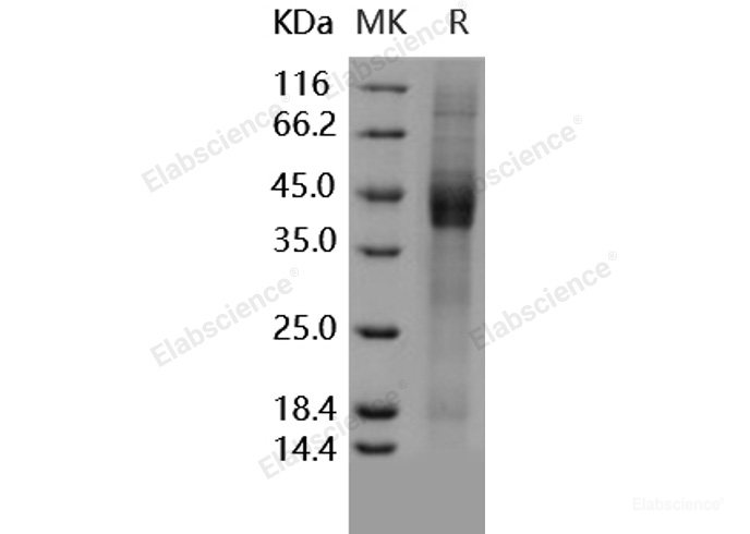 Recombinant Human IGFBP3 / IBP3 Protein (His tag)-Elabscience