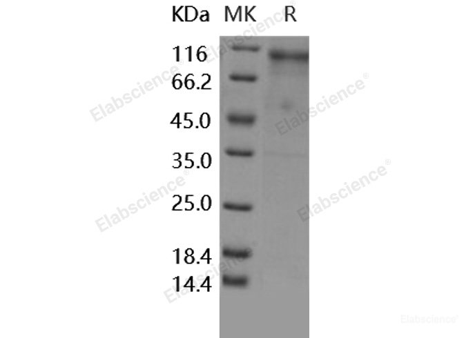 Recombinant Human / Rhesus HER4 / ErbB4 Protein (His tag)-Elabscience