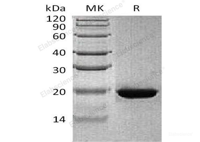 Recombinant Human RBP4 Protein (His Tag)-Elabscience