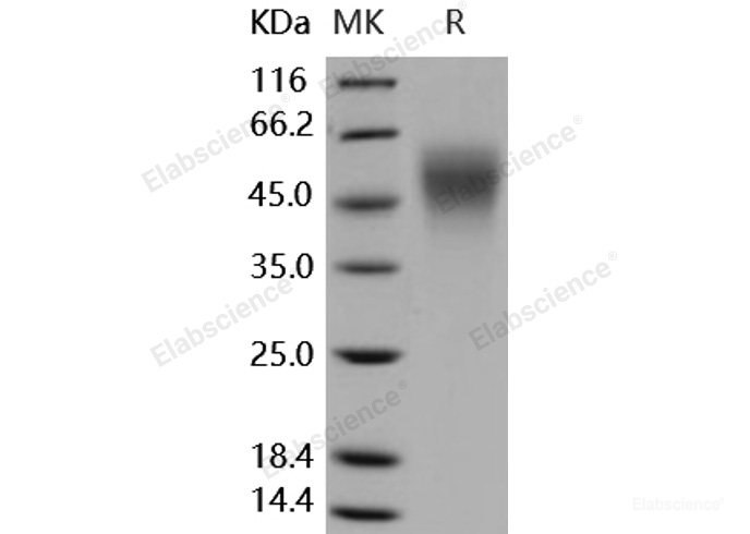 Recombinant Human ICAM-2 / CD102 Protein (His tag)-Elabscience