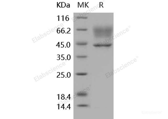 Recombinant Human SerpinA3 / AACT Protein (His tag)-Elabscience