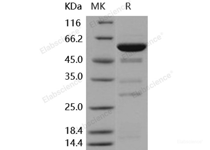 Recombinant Human Galectin-8 / LGALS8 Protein (GST tag)-Elabscience