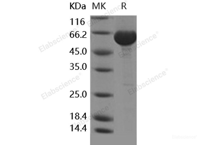 Recombinant Human Leukotriene A4 Hydrolase / LTA4H Protein (His tag)-Elabscience