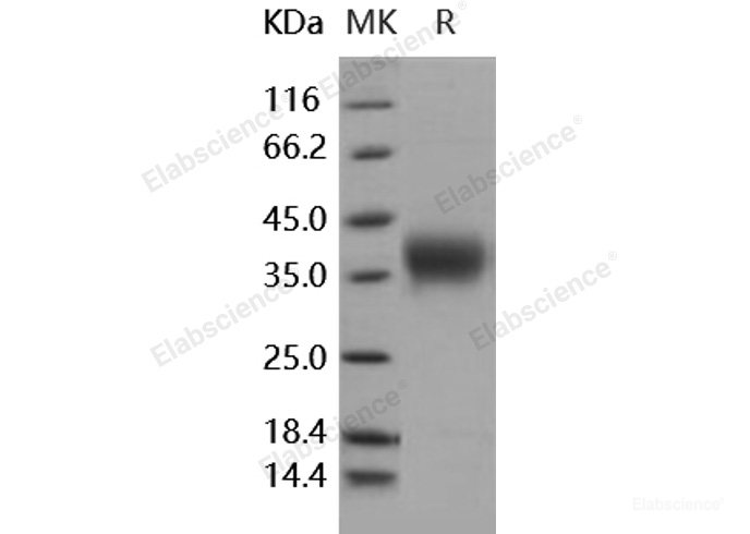 Recombinant Human ACVR2 / ACTRII / ACVR2A Protein (His tag)-Elabscience