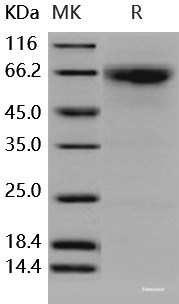 Recombinant Human MMP-8 / CLG1 Protein-Elabscience