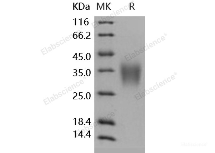 Recombinant Human ACVR2B / ActivinR-IIB Protein (His tag)-Elabscience