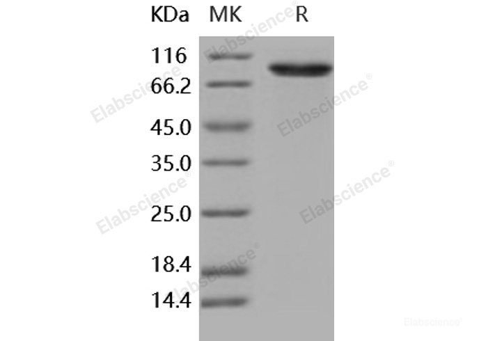 Recombinant Human DDR2 Kinase / CD167b Protein (Fc tag)-Elabscience