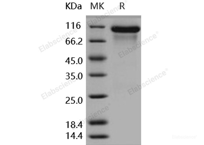 Recombinant Human HER3 / ErbB3 Protein (His tag)-Elabscience