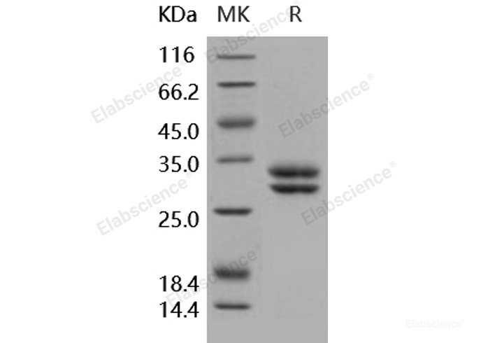 Recombinant Human JAM-A / F11R Protein (His tag)-Elabscience