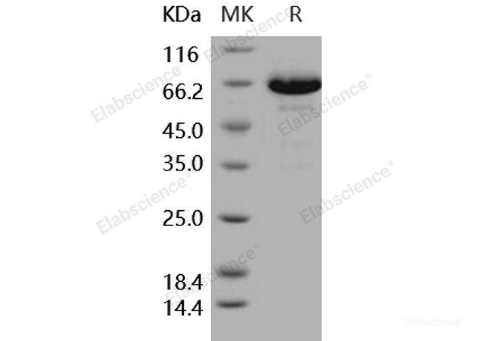 Recombinant Human EphB6 / EphB6 Protein (His tag)-Elabscience