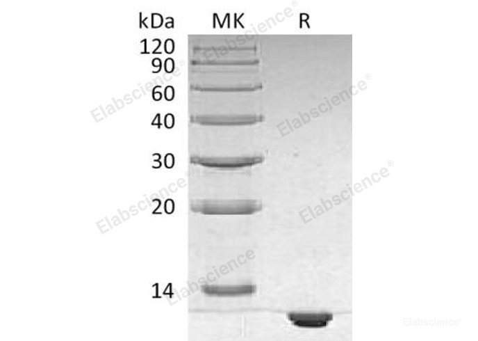 Recombinant Human S100B Protein (His Tag)-Elabscience