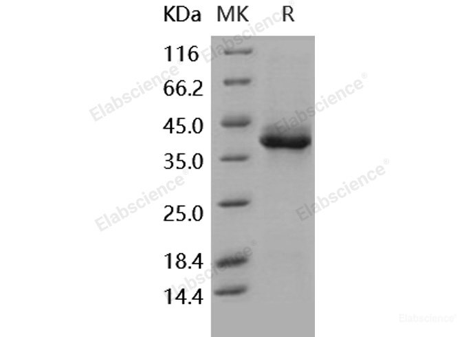 Recombinant Human S100B Protein (Fc tag)-Elabscience