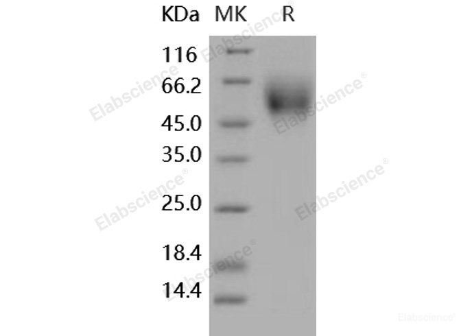 Recombinant Human DR6 / TNFRSF21 Protein (His tag)-Elabscience