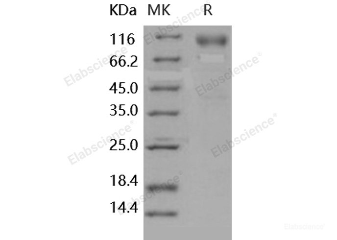 Recombinant Human DR6 / TNFRSF21 Protein (Fc tag)-Elabscience