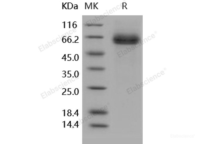 Recombinant Human DLL4 / Delta4 Protein (His tag)-Elabscience