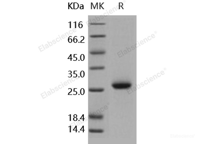 Recombinant Human NBL1 / DAND1 / DAN Protein (His tag)-Elabscience