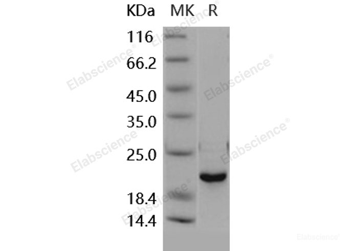 Recombinant Human DUSP3 / VHR Protein-Elabscience