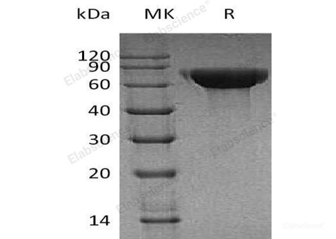 Recombinant Human CNDP1 Protein (His Tag)-Elabscience
