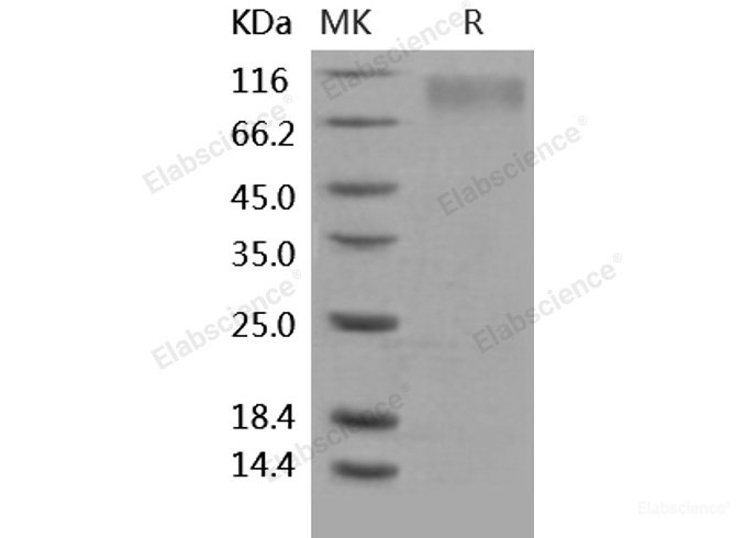 Recombinant Human TrkC / NTRK3 Protein (His tag)-Elabscience