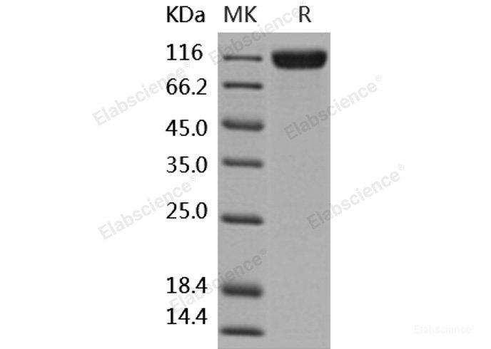 Recombinant Human TrkC / NTRK3 Protein (His & Fc tag)-Elabscience