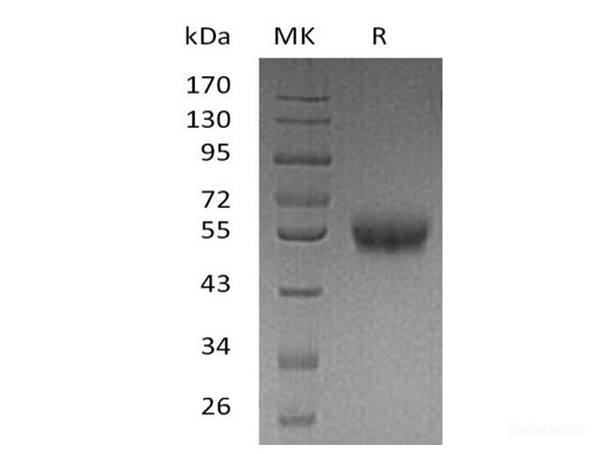 Recombinant Human 4-1BB/TNFRSF9/CD137 Protein(C-Fc-6His)-Elabscience