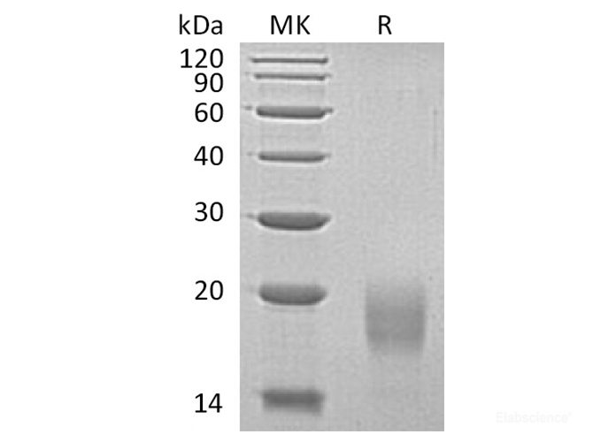 Recombinant Human Activin Receptor 1B/Activin RIB/ALK-4/ACVR1B Protein(C-6His)-Elabscience