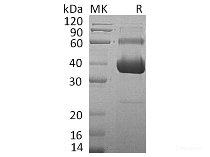 Recombinant Human Activin Receptor 2A/Activin RIIA/ACVR2A Protein(C-Fc-6His)-Elabscience