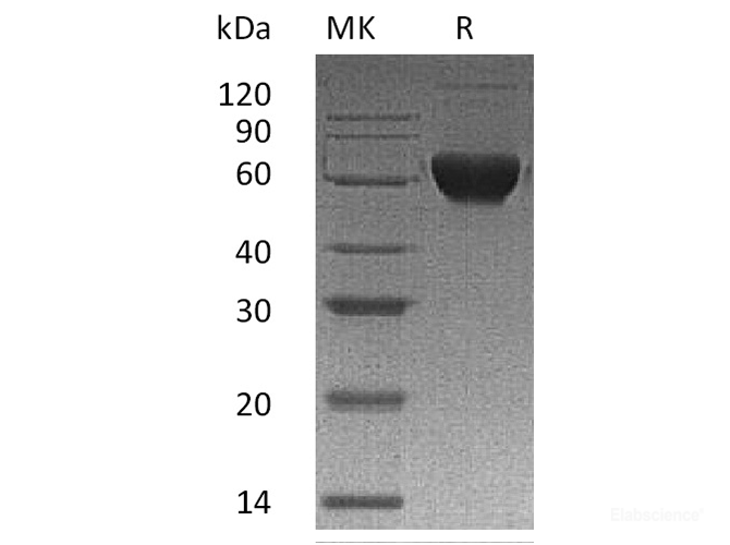 Recombinant Human Activin Receptor 2B/Activin RIIB/ACVR2B Protein(C-Fc-6His)-Elabscience