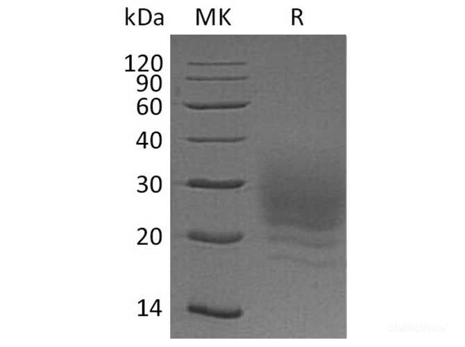 Recombinant Human BOC Protein/BOC Protein(C-6His)-Elabscience