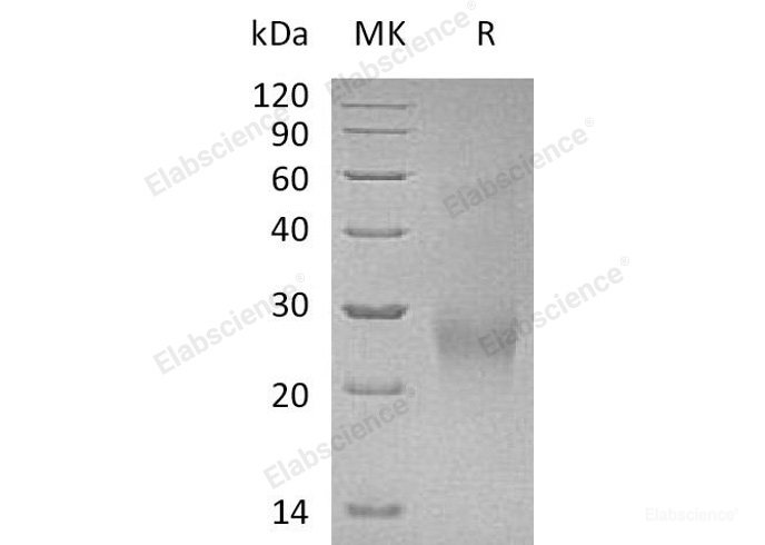 Recombinant Human CDK2AP2 Protein(C-6His)-Elabscience