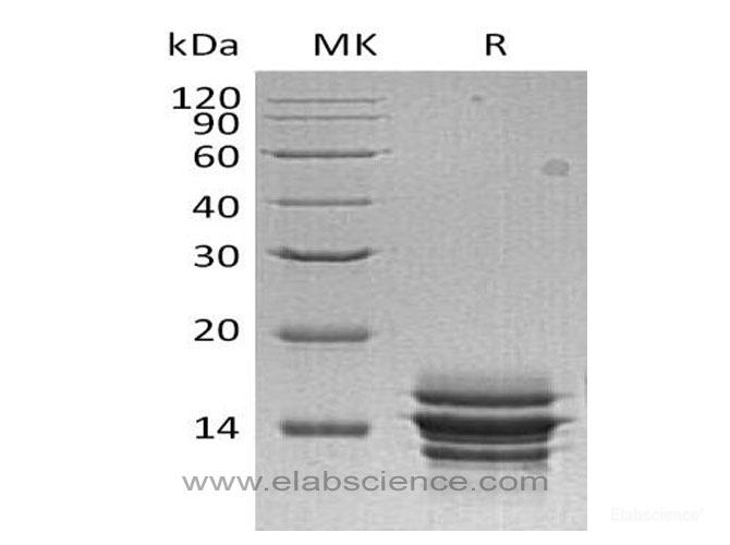 Recombinant Human C-X-C Motif Chemokine 7/CXCL7/NAP-2 Protein(C-6His)-Elabscience