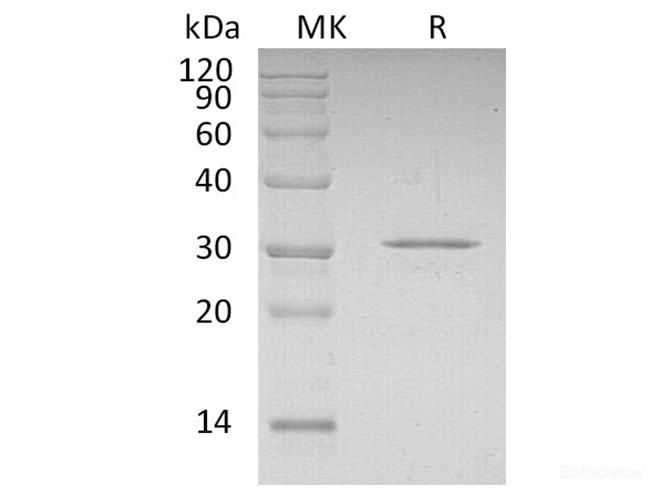 Recombinant Human Cyclin-Dependent Kinase Inhibitor 1B/CDKN1B Protein(N-6His)-Elabscience