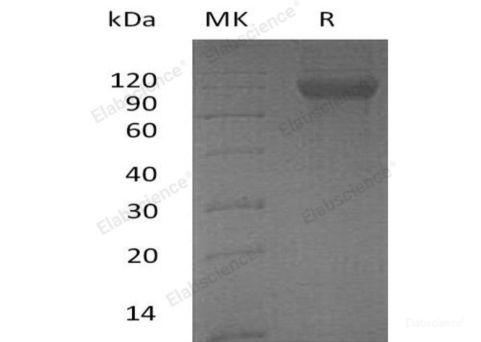 Recombinant Human DCBLD2/ESDN Protein(C-6His)-Elabscience