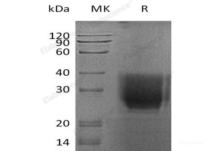 Recombinant Human EMMPRIN/Basigin/CD147 Protein(C-6His)-Elabscience