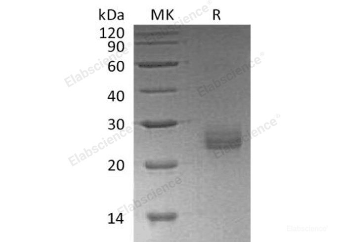 Recombinant Human Ephrin-A1/EFNA1/LERK-1 Protein(C-6His)-Elabscience