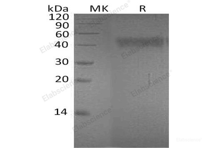 Recombinant Human Ephrin-A4/EFNA4 Protein(C-Fc-6His)-Elabscience