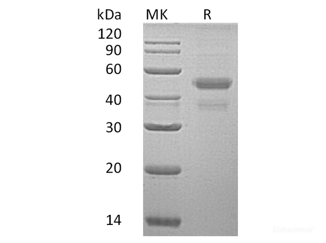 Recombinant Human ER Resident Protein 44/ERp44/TXNDC4 Protein(C-6His)-Elabscience