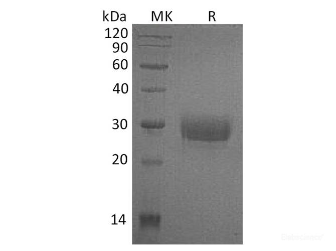 Recombinant Human Fc γ RIIa/FCGR2A/CD32a Protein(C-6His,H131)-Elabscience
