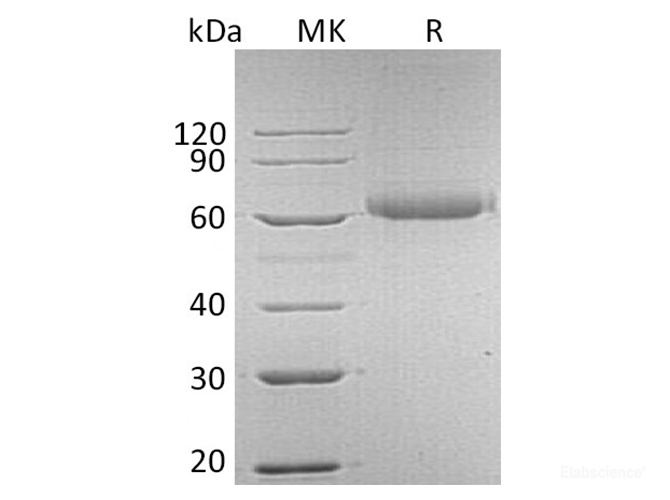Recombinant Human FGF R5/FGFRL1 Protein(C-6His)-Elabscience