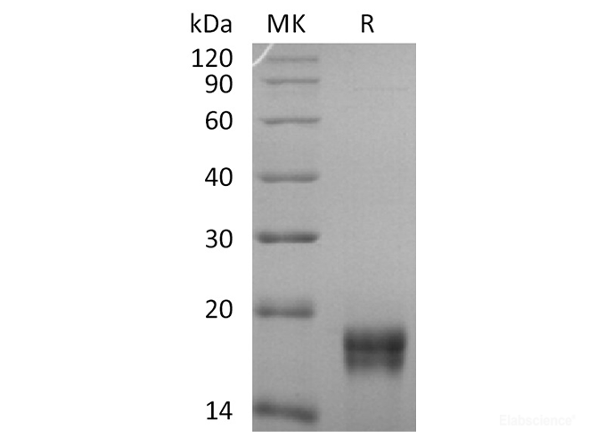 Recombinant Human GADD45β/GADD45B Protein(N-6His)-Elabscience