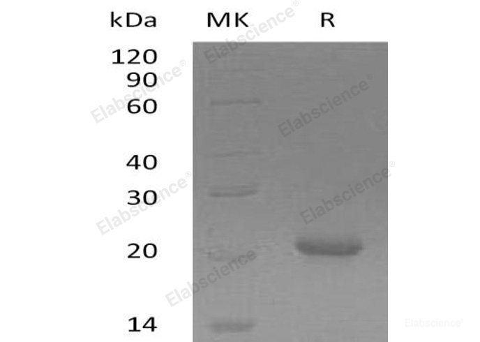 Recombinant Human GADD45γ/GADD45G Protein(N-6His)-Elabscience